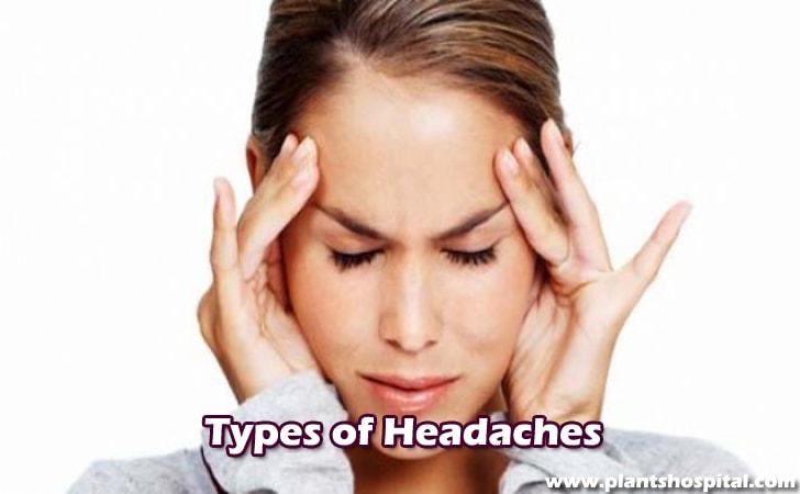 Types-of-headaches
