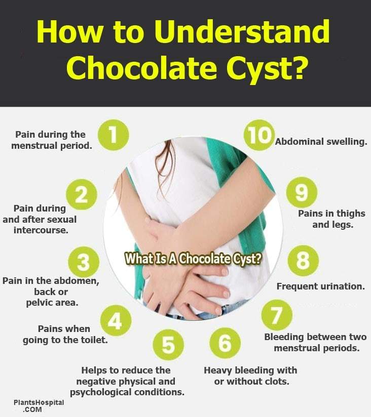 Chocolate-Cyst-graphic
