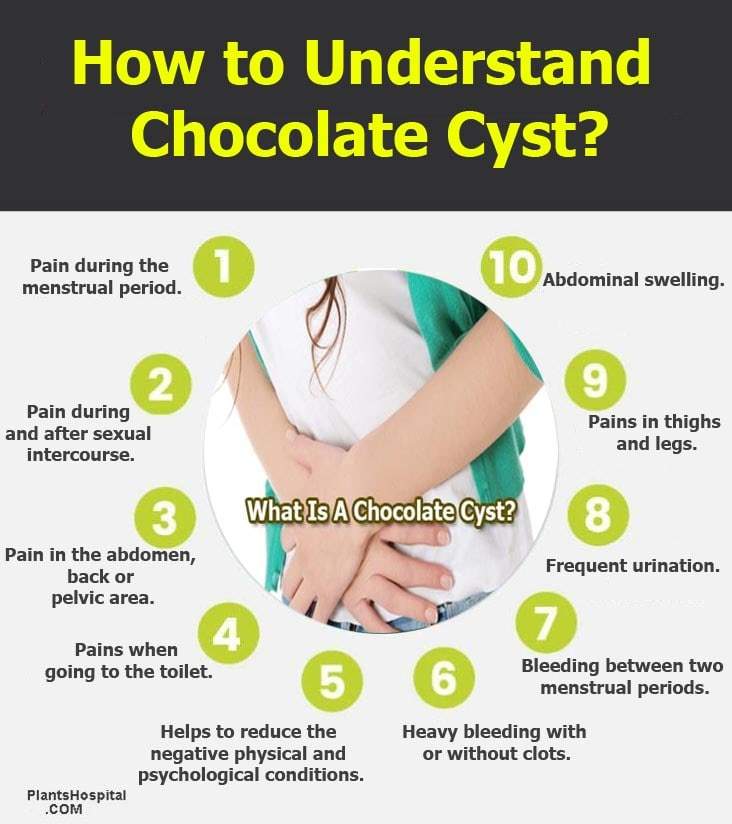 7 Powerful Home Remedies For Chocolate Cysts Treatment & Causes